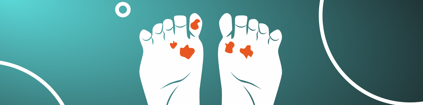 Diabetic Foot