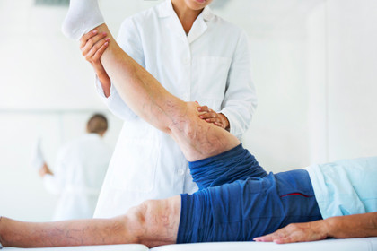 Blog - Varicose Veins Explained